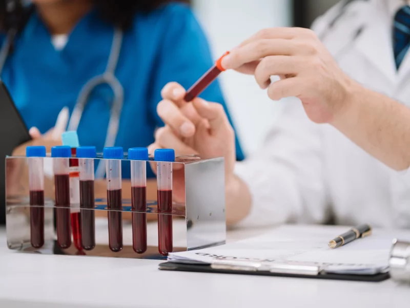 A pathology team analysing a blood test sample